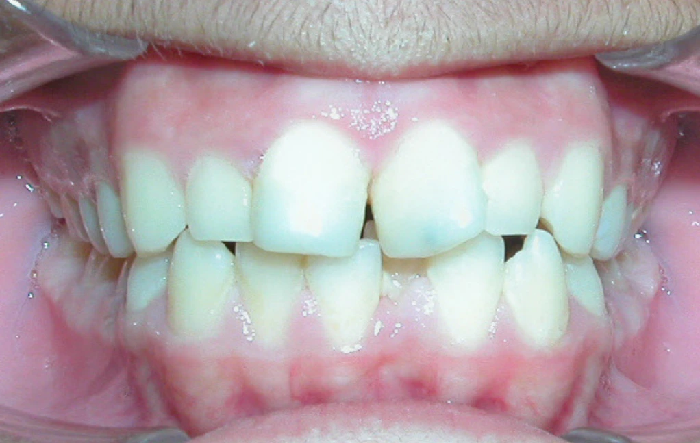 first image